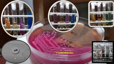 acinetobacter baumannii testing.